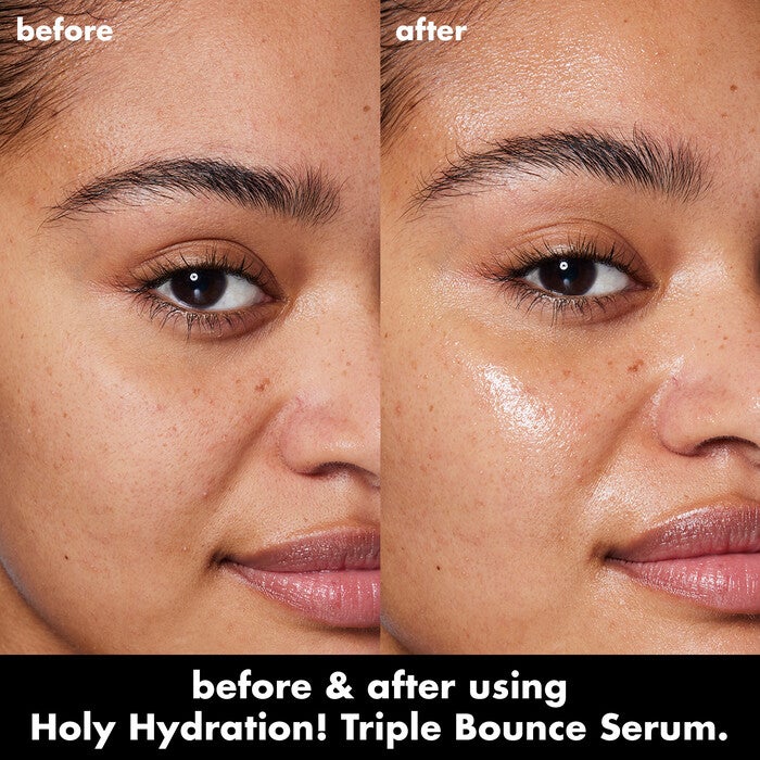Before and After Application of Hyaluronic Serum